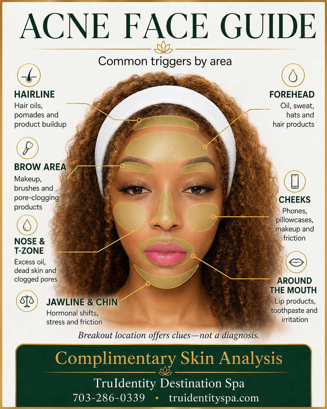 Acne face guide showing common breakout triggers by area: hairline, forehead, brow, cheeks, nose and T-zone, jawline and chin, and around the mouth
